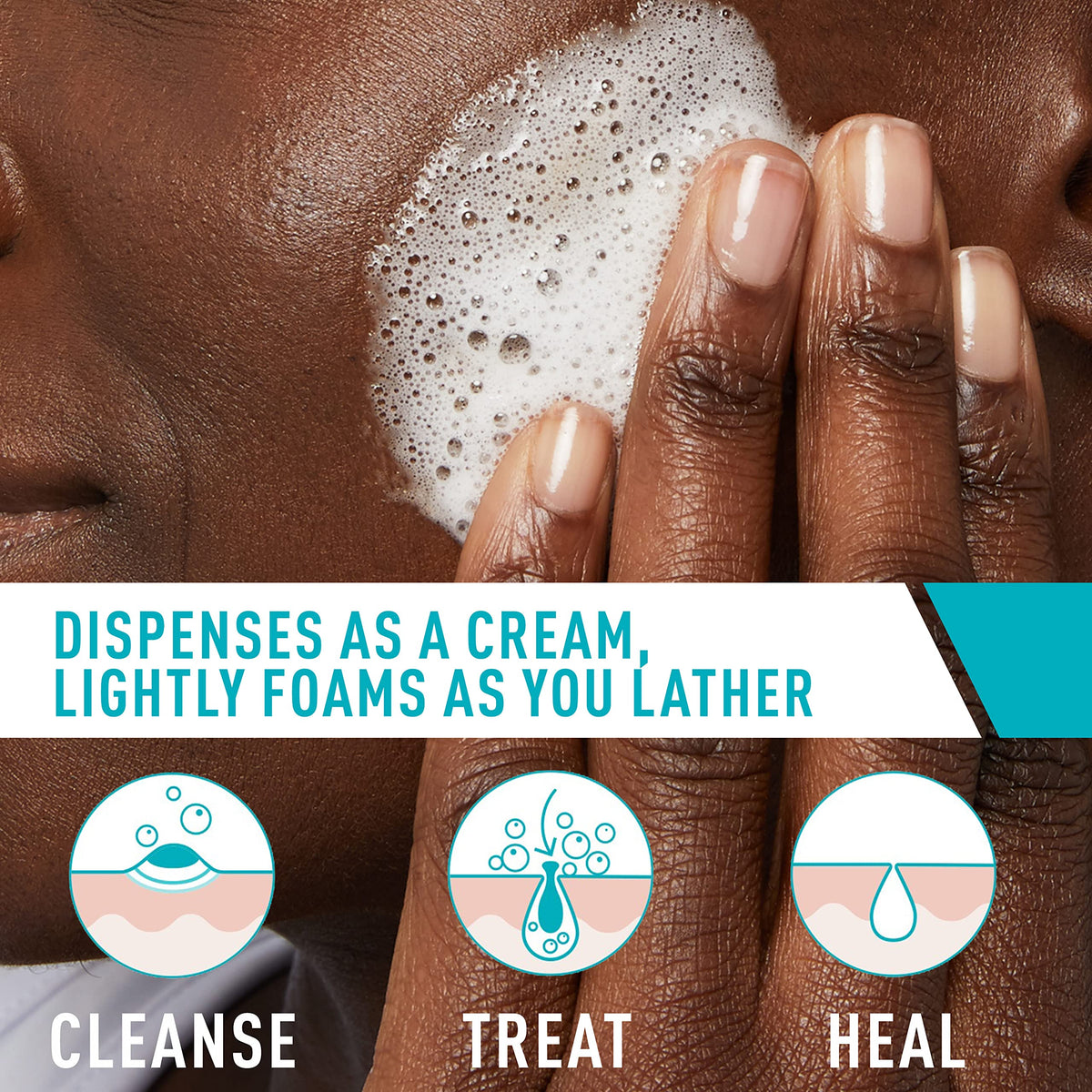 CERA VE Acne Foaming Cream Cleanser - Buynowpakistan