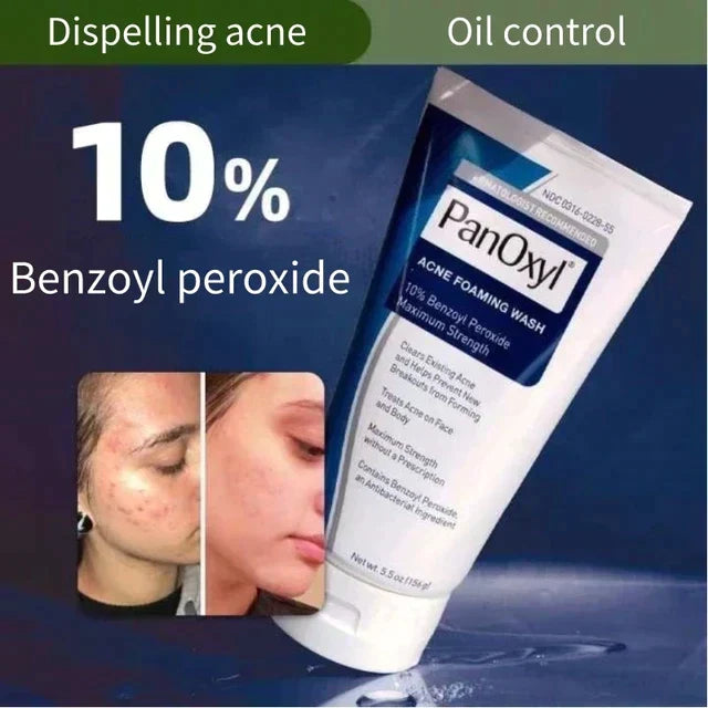 Panoxyl acne foaming wash benzoyl peroxide 10%