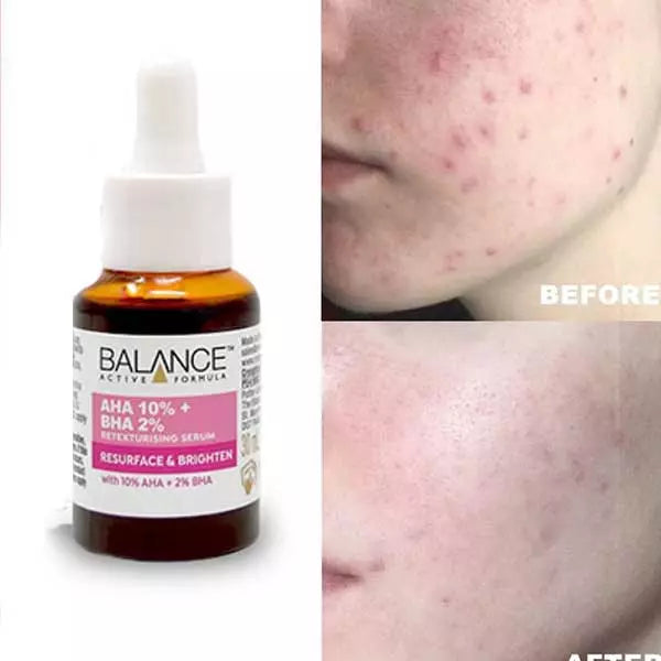Balance Active Formula AHA 10% + BHA 2% Formula - Buynowpakistan